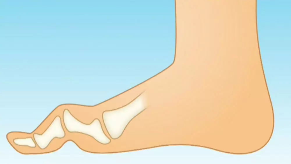 あなたは大丈夫 女性に多く見られる足のトラブル 原因 改善方法 名医のthe太鼓判 Tbsテレビ あなたは大丈夫 女性に多く見られる足のトラブル 原因 改善方法 名医のthe太鼓判 Tbsテレビ