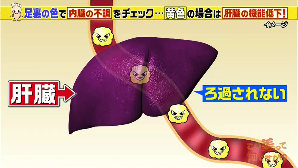 内臓の不調は 足の裏の色 でわかる 簡単セルフチェック Tbsテレビ 内臓の不調は 足の裏の色 でわかる 簡単セルフチェック Tbsテレビ