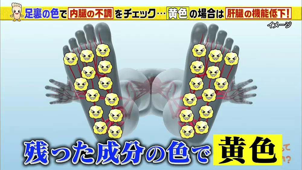 内臓の不調は 足の裏の色 でわかる 簡単セルフチェック Tbsテレビ 内臓の不調は 足の裏の色 でわかる 簡単セルフチェック Tbsテレビ
