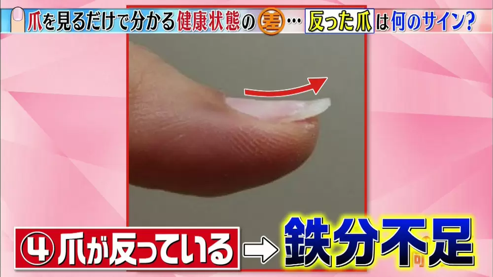 爪 に横線がある方 要注意です 健康セルフチェック Tbsテレビ 爪 に横線がある方 要注意です 健康セルフチェック Tbsテレビ
