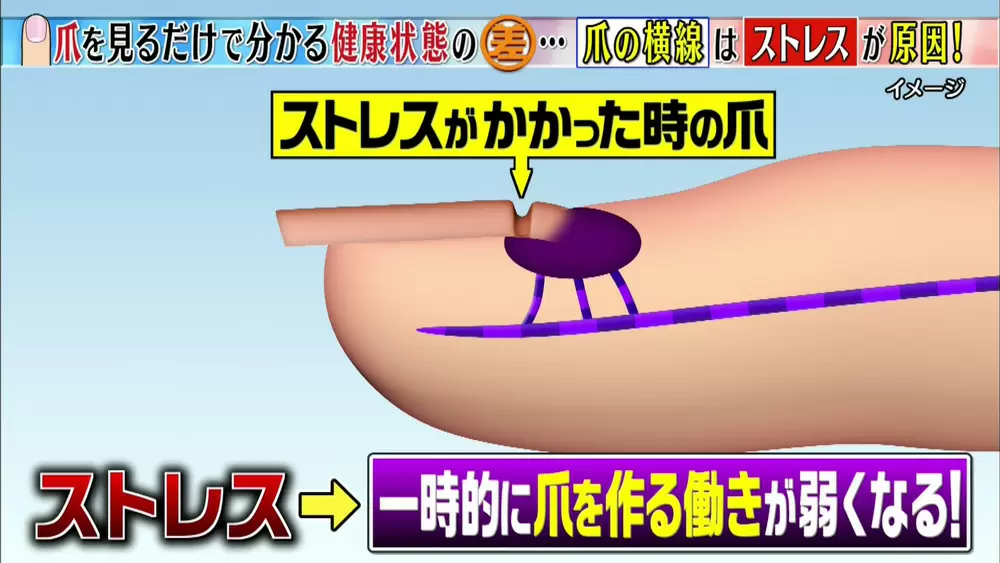 爪 に横線がある方 要注意です 健康セルフチェック Tbsテレビ 爪 に横線がある方 要注意です 健康セルフチェック Tbsテレビ