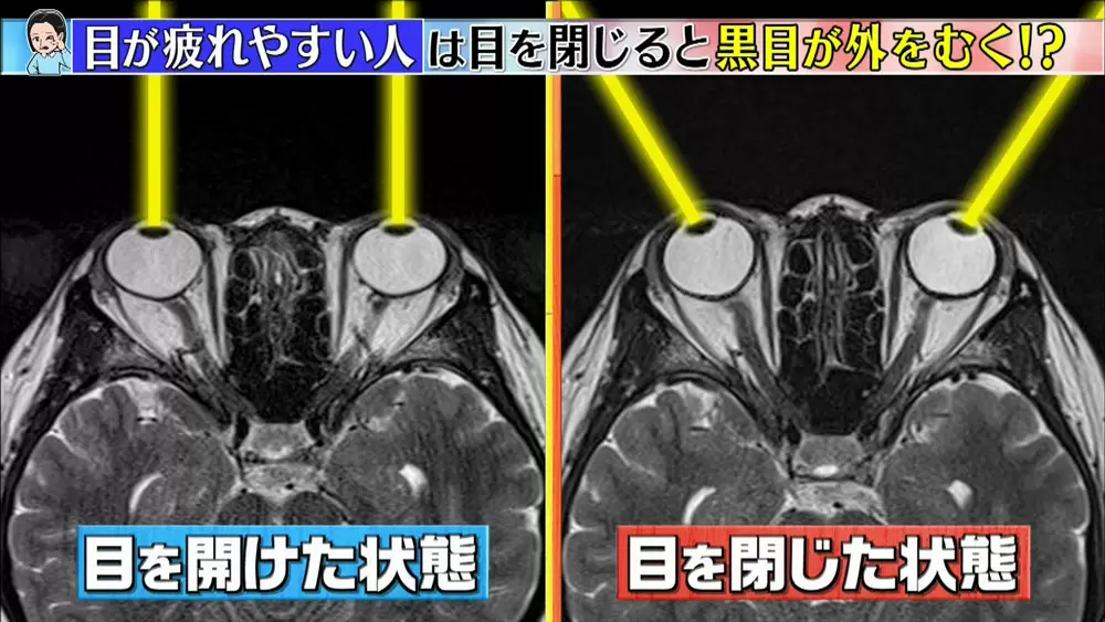 2人に1人 目が疲れやすい人にある特徴と改善方法とは この差って何ですか tbsテレビ