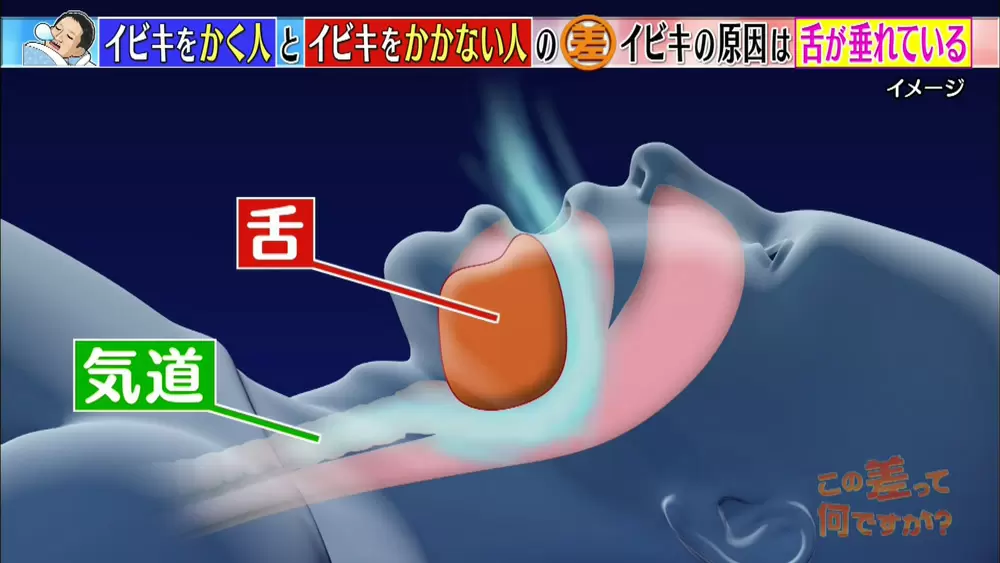 いびき が うるさい 人