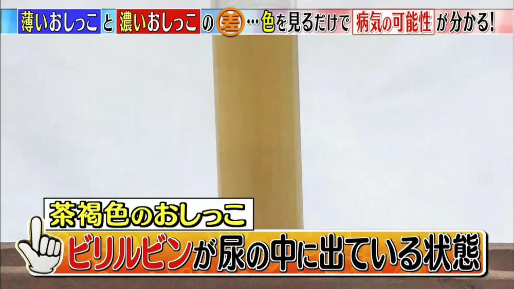 おしっこが透明 気を付けたい おしっこの色 は Tbsテレビ おしっこが透明 気を付けたい おしっこの色 は Tbsテレビ