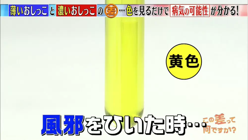 おしっこが透明 気を付けたい おしっこの色 は Tbsテレビ おしっこが透明 気を付けたい おしっこの色 は Tbsテレビ