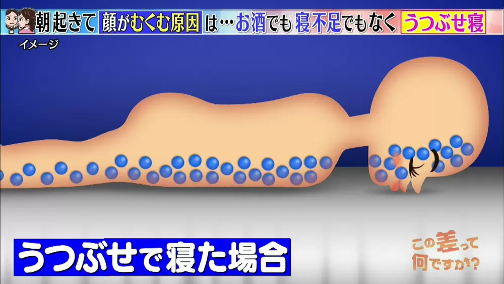 顔がむくむ本当の理由はこれ むくみ解消法も教えます Tbsテレビ 顔がむくむ本当の理由はこれ むくみ解消法も教えます Tbsテレビ