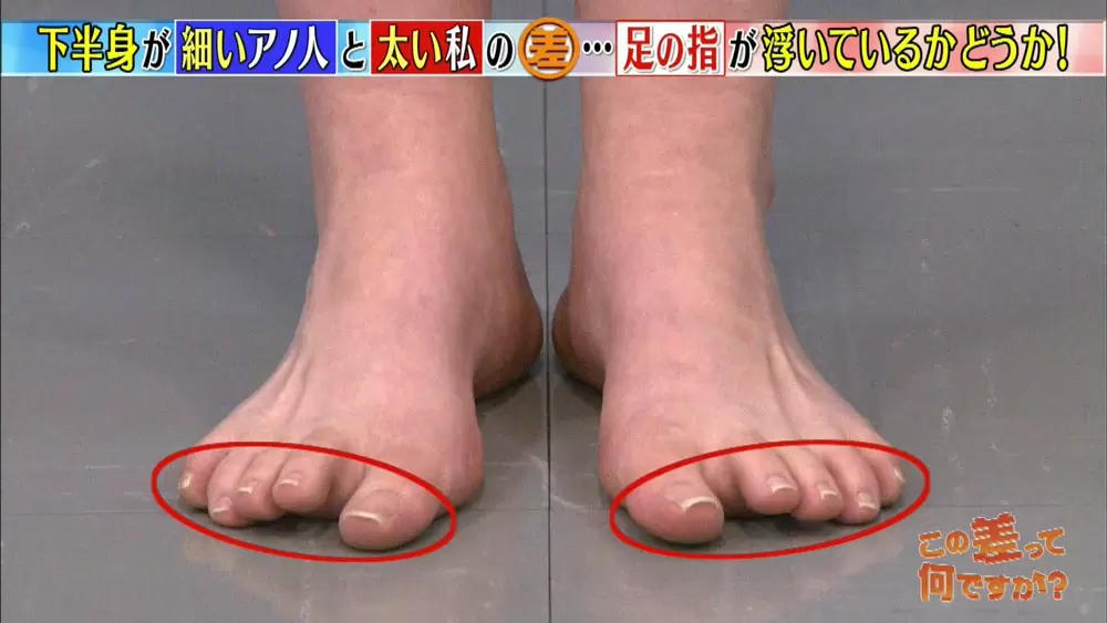 どんどん太くなる下半身は 足の指 が原因 Tbsテレビ どんどん太くなる下半身は 足の指 が原因 Tbsテレビ