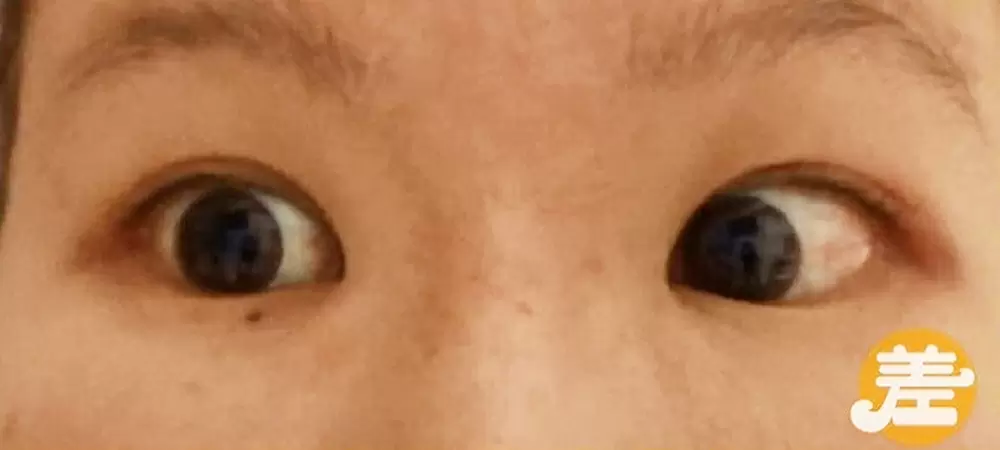毎日3分で二重まぶたに 整体師考案の 二重マッサージ が話題 Tbsテレビ 毎日3分で二重まぶたに 整体師考案の 二重マッサージ が話題 Tbsテレビ