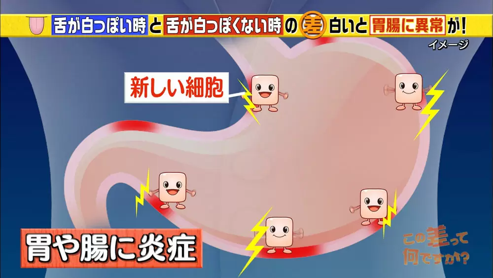 白い舌は胃腸のsos 舌でわかる健康学 Tbsテレビ 白い舌は胃腸のsos 舌でわかる健康学 Tbsテレビ