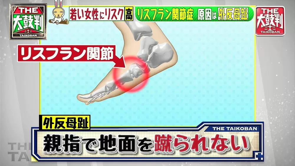 足の甲に痛みがある人は危険 リスフラン関節症とは 名医のthe太鼓判 Tbsテレビ