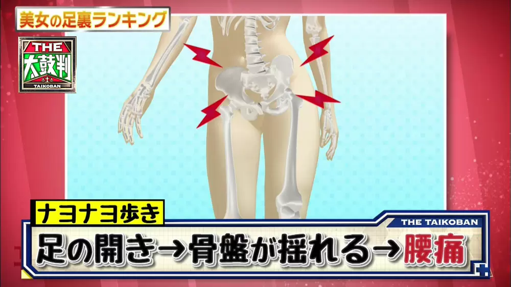 足にタコがある人は要注意 歩き方が腰痛の原因かも 名医のthe太鼓判 Tbsテレビ