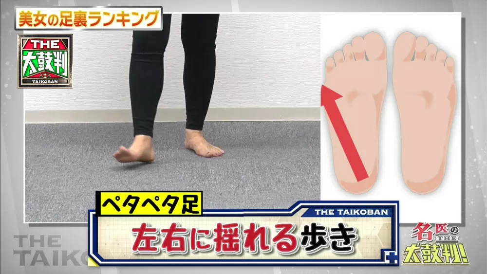 あなたは大丈夫 女性に多く見られる足のトラブル 原因 改善方法 名医のthe太鼓判 Tbsテレビ あなたは大丈夫 女性に多く見られる足のトラブル 原因 改善方法 名医のthe太鼓判 Tbsテレビ