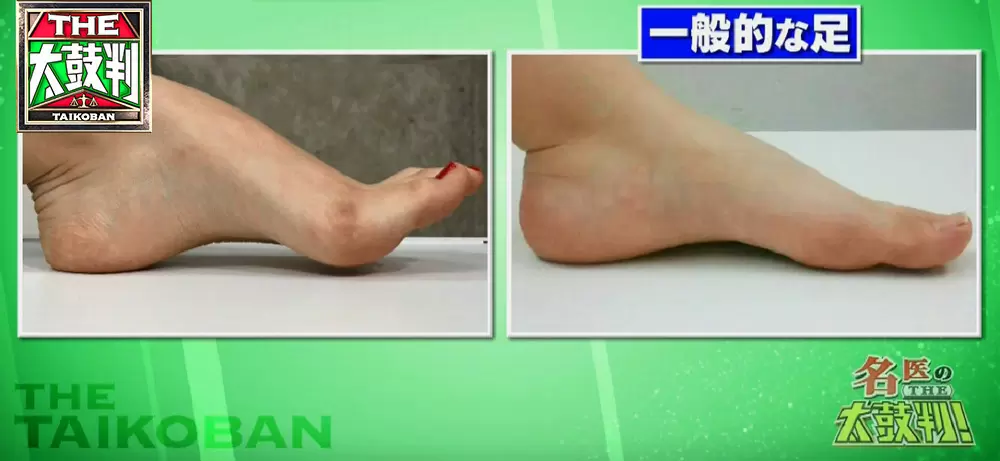 小さい靴を履き続けると危険 かかとに痛みがある人は要注意 名医のthe太鼓判 Tbsテレビ 小さい靴を履き続けると危険 かかとに痛みがある人は要注意 名医のthe太鼓判 Tbsテレビ