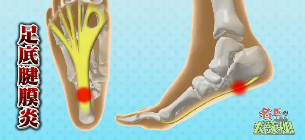 小さい靴を履き続けると危険 かかとに痛みがある人は要注意 名医のthe太鼓判 Tbsテレビ 小さい靴を履き続けると危険 かかとに痛みがある人は要注意 名医のthe太鼓判 Tbsテレビ