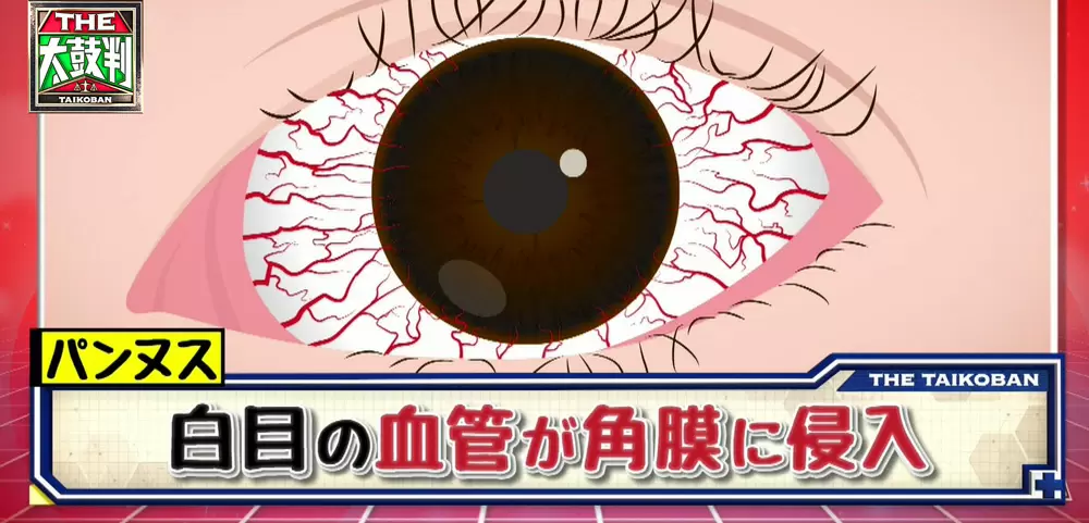 不十分なクレンジングは 失明 の原因にも 正しいアイメイク落としのポイントは 名医のthe太鼓判 Tbsテレビ 不十分なクレンジングは 失明 の原因にも 正しいアイメイク落としのポイントは 名医のthe太鼓判 Tbsテレビ