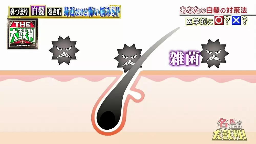 急に増える白髪の原因は 名医のthe太鼓判 Tbsテレビ 急に増える白髪の原因は 名医のthe太鼓判 Tbsテレビ