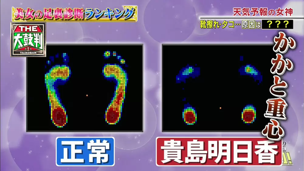 毎日ヒールを履く人は要注意 知っておきたい かかと重心 改善法 名医のthe太鼓判 Tbsテレビ 毎日ヒールを履く人は要注意 知っておきたい かかと重心 改善法 名医のthe太鼓判 Tbsテレビ