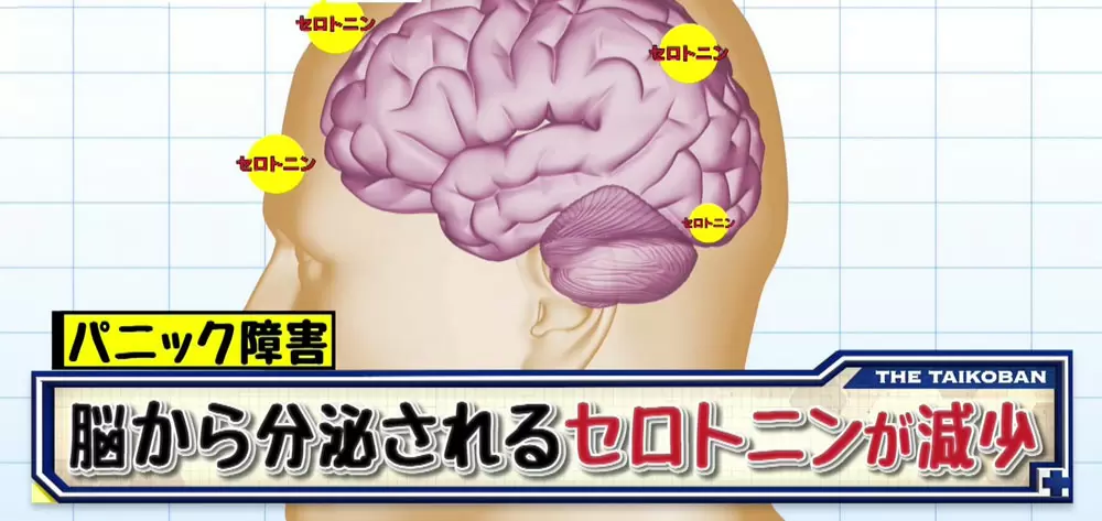 誰にでも起こりうる現代病 パニック障害 を知ろう 名医のthe太鼓判 Tbsテレビ 誰にでも起こりうる現代病 パニック障害 を知ろう 名医のthe太鼓判 Tbsテレビ