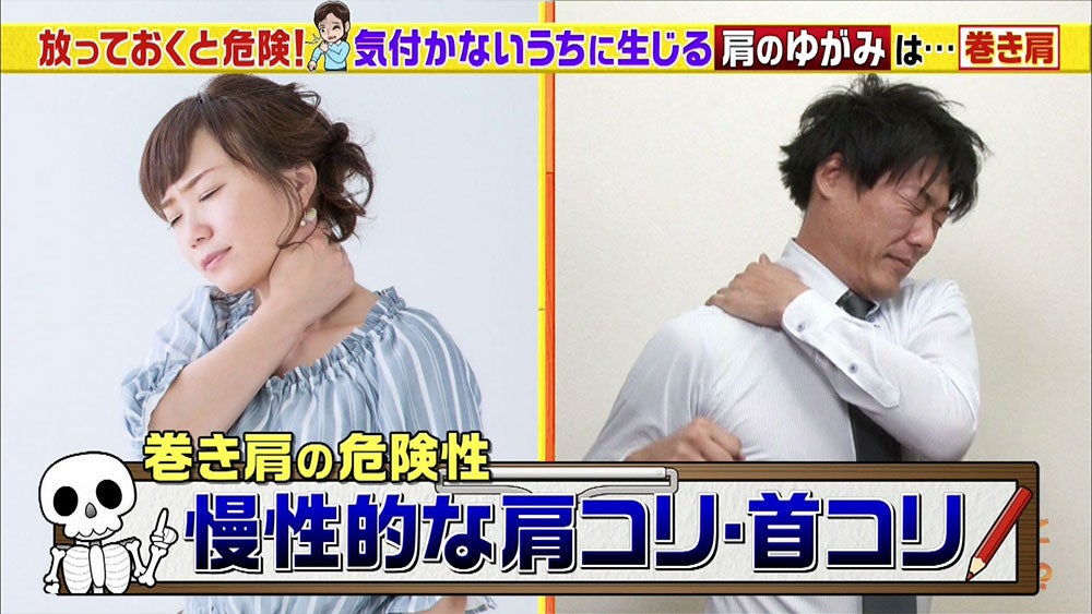 巻き肩 で起こる不調とは セルフチェックで改善 Tbsテレビ