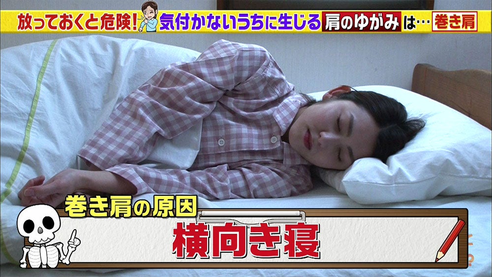 巻き肩 で起こる不調とは セルフチェックで改善 Tbsテレビ